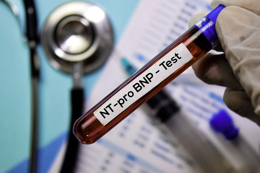 nano-l-doctors-p-tests-cardiology-02
