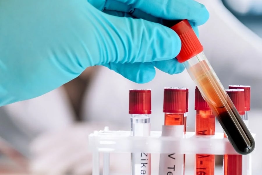 nano-l-doctors-p-tests-gastroenterology-02