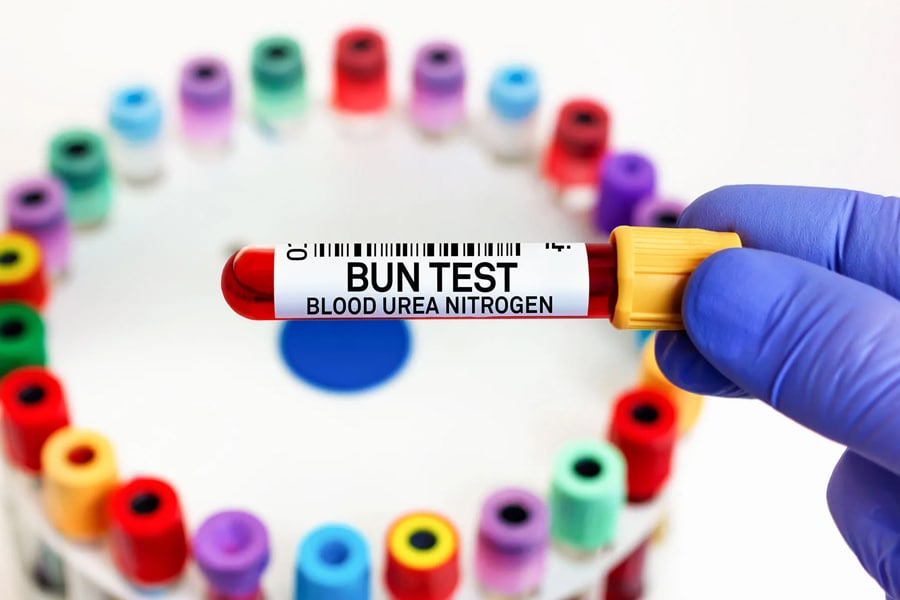 nano-l-doctors-p-tests-nephrology-02