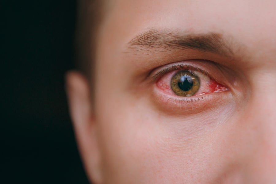 nano-l-doctors-p-tests-ophthalmology-02