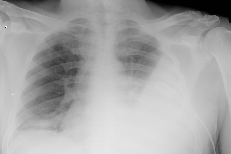 nano-l-doctors-p-tests-pulmonology-respiratory-01