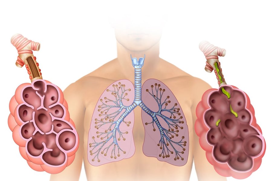 nano-l-doctors-p-tests-pulmonology-respiratory-02