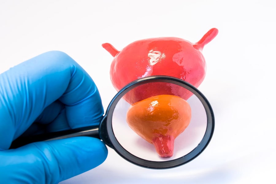 nano-l-doctors-p-tests-urology-01